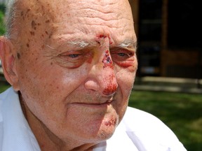 Serge Zubko who claims he was beaten by police in his own home.

Morris Lamont/QMI AGENCY