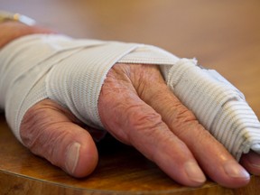 Robert (Bob) Bowie, 77, shows his injured hand and arm at his home as he recovers from an attack outside of his garage near 122 Street and 136 Avenue in Edmonton, Alta., on Thursday, Feb. 27, 2014. Darcy Loyie, 29, has been charged in the attack, which occurred on Feb. 26, 2014. Ian Kucerak/Edmonton Sun