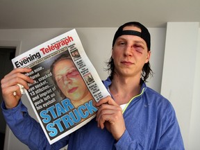 Rory Rawlyk suffered a broken nose, fractured cheekbone, and cracked eye socket. (The Dundee Evening Telegraph)