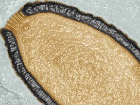 Transmission electron microscopy color image of a Pithovirus sibericum cross-section. This virion, dating back more than 30,000 years, is 1.5 μm long and 0.5 μm wide, which makes it the largest
virus ever discovered.
(Julia Bartoli & Chantal Abergel, IGS, CNRS/AMU)