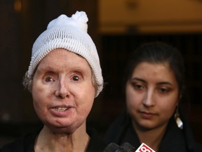 Charla Nash (L) speaks to the media, next to her daughter Briana Nash, at the Legislative Office Building in Hartford, Connecticut March 21, 2014.  (REUTERS/Eduardo Munoz)