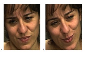 A woman's facial expression of pain, one real and one fake, is pictured in two different images, courtesy of Kang Lee and Marian Bartlett in this undated handout combo picture. Scientists have developed a computer with advanced pattern recognition abilities that performed much better than humans in an experiment in which they were asked to differentiate between people in genuine pain and people who were just faking it. The real expression of pain is image B on the right.  REUTERS/Kang Lee, Marian Bartlett/UC San Diego Jacobs School of Engineering/Handout