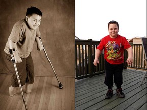 Before and after Skyler Jepson. Eric and Jennifer Jepson had a wonderful Easter gift Sunday: their eight-year-old son Skyler walked all by himself from the living room and turned into the kitchen without losing his balance. And Tyler did not need his crutches or any other mobility aids. Photo Supplied