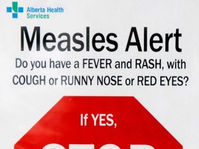 measles sign