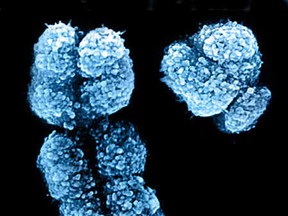 Human X and Y chromosomes determine our sex. Females have two X chromosomes and males have an X and a Y chromosome. New discoveries suggest that, rather than heading for extinction, the Y chromosome has been stable for at least 25 million years, while the X chromosome has started a period of rapid evolution. (Karakalpak Genetics)