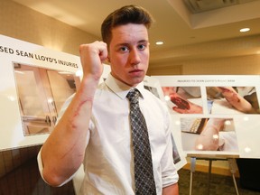 Sean Lloyd displays his injuries sustained when he accidentally put his arm through a wired glass door window at his school in Halton. (STAN BEHAL/Toronto Sun)