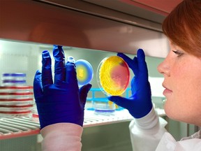 CDC microbiologist, Valerie Albrecht, holds up two plates of methicillin-resistant Staphylococcus aureus (MRSA) in this undated CDC handout photo. 
REUTERS/CDC/Handout