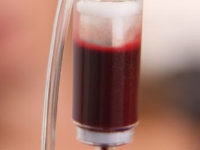 Infusion of young blood could reverse aging. (Fotolia)