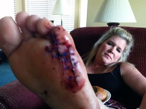 Kimberly Popp, wife of Montreal Alouettes general manager Jim Popp, required dozens of stitches after a shark bite in South Carolina. (@BigDaddyMville)