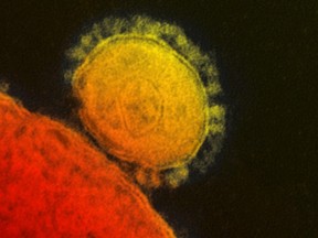 The Middle East respiratory syndrome (MERS) coronavirus is seen in an undated transmission electron micrograph from the National Institute for Allergy and Infectious Diseases (NIAID). (REUTERS/National Institute for Allergy and Infectious Diseases/Handout via Reuters)