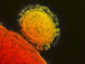 The Middle East Respiratory Syndrome (MERS) coronavirus is seen in an undated transmission electron micrograph from the National Institute for Allergy and Infectious Diseases (NIAID) in this file handout photo.

REUTERS/National Institute for Allergy and Infectious Diseases/Handout via Reuters/Files