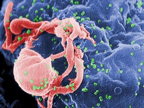 HIV virus.

(Wikimedia commons)