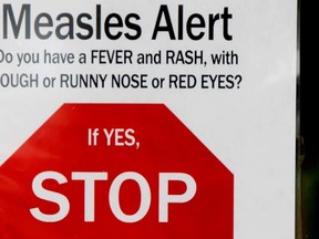 Measles outbreak. (Tom Braid/QMI Agency)