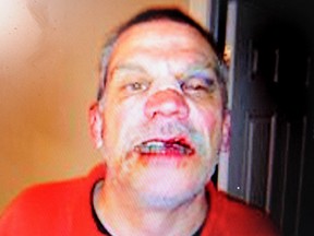Wayne Daniels is seen in the aftermath of a brutal beating.