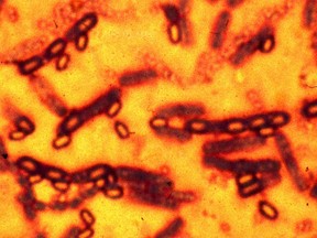 A microscopic picture of spores and vegetative cells of Bacillus anthracis which causes the disease anthrax is pictured in this undated file photograph. (REUTERS/Files)