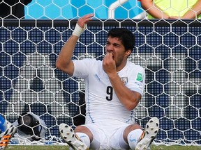 Uruguay's Luis Suarez holds his teeth during the 2014 World Cup Group D soccer match between Uruguay and Italy at the Dunas arena in Natal June 24, 2014. Italy's Giorgio Chiellini accused Suarez of biting his shoulder. (REUTERS/Yves Herman)