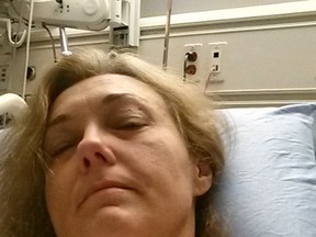 When Beth Jefferson read last week about Kim Schellenberg (shown here) after having surgery after barbecue brush wire got lodged in her throat, it reminded her of her own brush with death. HANDOUT PHOTO/QMI AGENCY