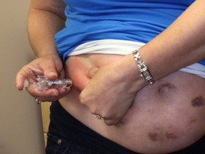 Angela Donatucci, of Ottawa, giving herself one of two daily injections of low molecular weight heparin. Note the bruising below and to the right of her belly button. A clinical trial led by researchers at The Ottawa Hospital found the common blood thinner given to pregnant women at risk of developing blood clots is ineffective. 
The study was published Thursday, July 24, 2014 in The Lancet. (Photo courtesy of the Ottawa Hospital Research Institute)