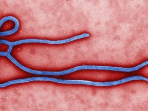 This colorized transmission electron micrograph (TEM) obtained March 24, 2014 from the Centers for Disease Control(CDC) in Atlanta, Georgia, reveals some of the ultrastructural morphology displayed by an Ebola virus virion. (AFP PHOTO / HANDOUT / CDC / Cynthia Goldsmith)