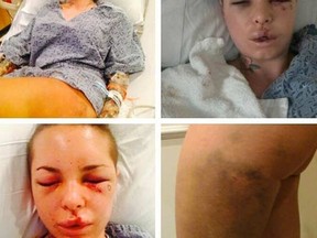 A combination photo tweeted by assault victim Christy Mack. (Twitter)