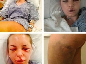 A combination photo tweeted by assault victim Christy Mack. (Twitter)
