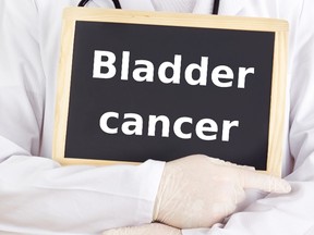 Invisible blood in urine signals bladder cancer (Fotolia)
