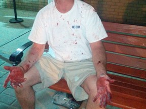 A photo of the aftermath outside a pub on 17 Ave. S.W. Witnesses allege they watched bouncers of an area bar beat the man bloody. (Photo supplied by Harmon Kandola)