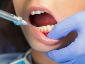 The University of Alberta School of Dentistry is now offering a Neuromodulators course, where substances like Botox, Xeomin, and Dysport that alter nerve impulse transmission are used. Image/Fotolia.com