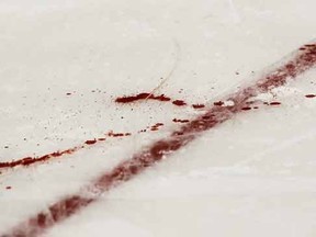 Pools of blood formed on the ice inside Peoria's Carver Arena Saturday night following a gruesome injury to an SPHL player. (Note: This image was not taken Saturday night)