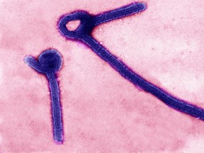 A transmission electron micrograph shows Ebola virus particles in this undated handout image released by the U.S. Army Medical Research Institute of Infectious Diseases (USAMRIID) in Fredrick, Maryland.   REUTERS/USAMRIID/Handout
