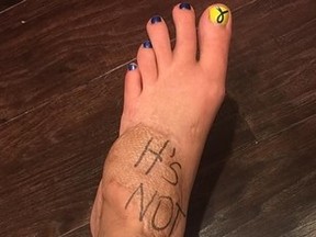 Boston Marathon bombing victim Rebekah DiMartino wrote a witty break up letter to her soon-to-be amputated leg. (newday.newhope.rebekahgregory/Facebook)