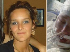 Tanya St. Arnauld was doused with acid as she stood on the front steps of her apartment in Longueuil in August 2012. Right, St. Arnauld is pictured in hospital following the attack. (TVA/Supplied Photos)