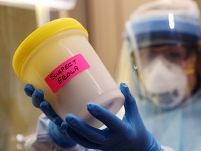 Julie Craig, a senior technologist for point-of-care testing in the laboratory of Belleville General Hospital, holds a container similar to that which held specimens from a suspected Ebola virus patient at Belleville General Hospital. While concerned for her own health, she said, her main worry was for the patient. 
Luke Hendry/Intelligencer