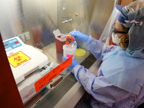 Julie Craig, a senior technologist for point-of-care testing in the laboratory of Belleville General Hospital, holds a container similar to that which held specimens from a suspected Ebola virus patient at Belleville General Hospital. While concerned for her own health, she said, her main worry was for the patient.
Luke Hendry/Intelligencer