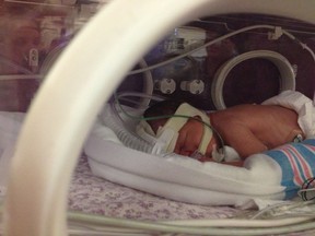 Reece Kimmel was born Dec. 10, 2013. She was nine-weeks early, and her parents were given a $950,000 bill for the hospital stay after their travel insurance was denied. (QMI AGENCY/FAMILY PHOTO)