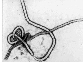 The Ebola Virus is shown in this undated electron micrograph photo provided by the Centers for Disease Control and Prevention in Atlanta, Ga. (FILE PHOTO)