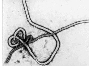 The Ebola Virus is shown in this undated electron micrograph photo provided by the Centers for Disease Control and Prevention in Atlanta, Ga. (FILE PHOTO)