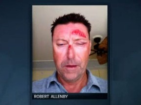 PGA golfer Robert Allenby was allegedly kidnapped, beaten and robbed Friday night. (Golf channel screen grab)