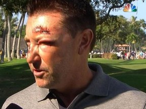 Robert Allenby claims he was assaulted, beaten and dumped.