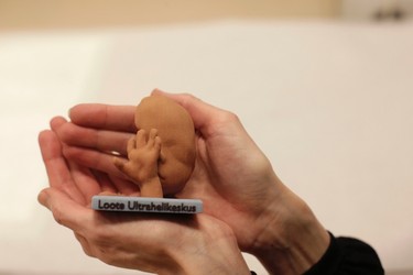 Mother-to-be Maarja Lants holds a three-dimensional (3D) print model of her unborn baby in Tallinn, Estonia, Jan. 28, 2015.  REUTERS/Ints Kalnins