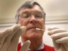 Dr. Jim Dickinson, a family physician in the Department of Family Medicine at the University of Calgary Cumming School of Medicine, poses and demonstrates how a nasal swab is used to obtain a sample in Calgary, Alta on Friday February 6, 2015. Dickinson is overseeing the progress of flu vaccinations. Jim Wells/Calgary Sun/QMI Agency