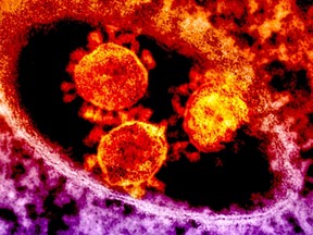 Particles of the Middle East respiratory syndrome (MERS) coronavirus that emerged in 2012 are seen in an undated colorized transmission electron micrograph from the National Institute for Allergy and Infectious Diseases (NIAID).  An Illinois resident tested positive for Middle East Respiratory Syndrome after being in contact with an infected patient, though he did not show signs of illness, U.S. health officials said on Saturday.  REUTERS/National Institute for Allergy and Infectious Diseases/Handout via Reuters