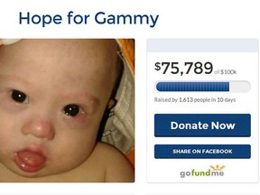 Campaigns like this one for six-month-old Gammy, who was left in a surrogate mother's care because he has Down syndrome and a congenital heart defect, get a huge response on crowdfunding websites. (GoFundMe.com screengrab/QMI Agency)