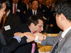U.S. Ambassador to South Korea Mark Lippert leaves after he was slashed in the face by Kim Ki-jong, a member of a pro-Korean unification group, at a public forum in central Seoul in this handout picture provided by Munhwa Ilbo on March 5, 2015. (REUTERS/Munhwa Ilbo)