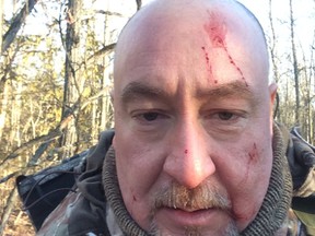 Roberto Giugovaz took this selfie after being attacked by a fisher on his property north of Kingston.