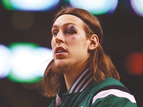 Celtics forward Kelly Olynyk was elbowed in the face by a teammate during a game last week. (AFP)