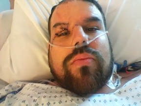 Winnipeg wrestler A. J. Larocque, whose ring name is A. J. Sanchez, remains in hospital recovering from a long list of injuries following a head-on collision on Gateway Road on March 21.
