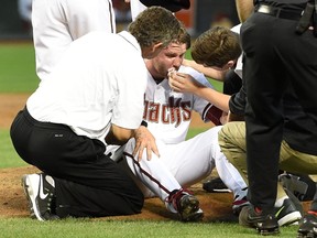 Archie Bradley of the Arizona Diamondbacks is tended to on the pitcher’s mound after getting hit in the face with a line drive during MLB play against the Colorado Rockies at Chase Field April 28, 2015 in Phoenix. (Norm Hall/Getty Images/AFP)