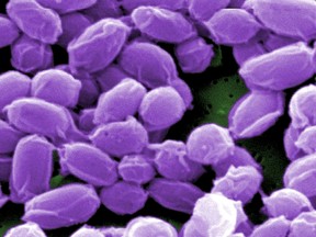 Spores from the Sterne strain of anthrax bacteria (Bacillus anthracis) are pictured in this handout scanning electron micrograph (SEM) obtained by Reuters May 28, 2015. The U.S. military mistakenly sent live anthrax bacteria to laboratories in nine U.S. states, a U.S. air base in South Korea and now Australia, after apparently failing to properly inactivate the bacteria last year, U.S. officials said. REUTERS/Center for Disease Control/Handout via Reuters