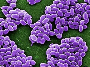 Spores from the Sterne strain of anthrax bacteria (Bacillus anthracis) are pictured in this handout scanning electron micrograph obtained by Reuters May 28, 2015. (Center for Disease Control/Handout via Reuters)